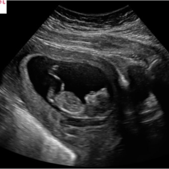 Babylist Registry Photo.