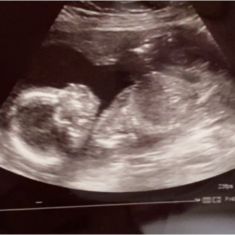 Babylist Registry Photo.