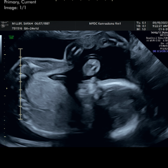 Babylist Registry Photo.
