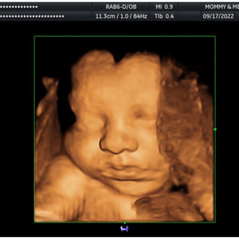 Babylist Registry Photo.