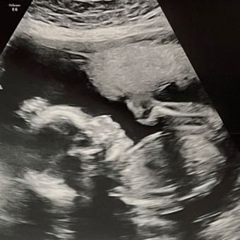 Babylist Registry Photo.