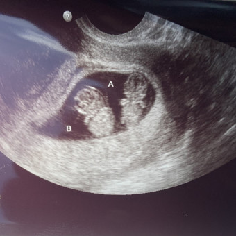 Babylist Registry Photo.