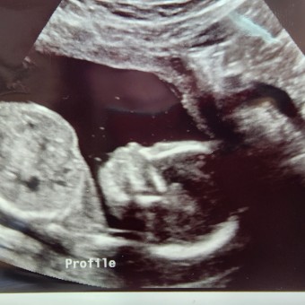 Babylist Registry Photo.