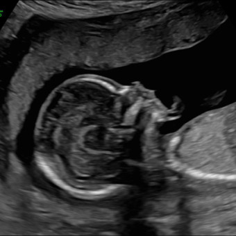 Babylist Registry Photo.