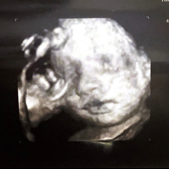 Babylist Registry Photo.