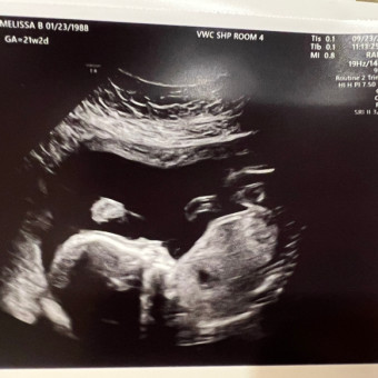 Babylist Registry Photo.