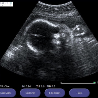 Babylist Registry Photo.
