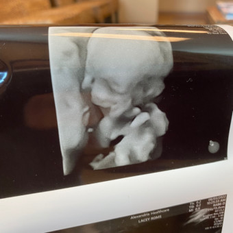 Babylist Registry Photo.