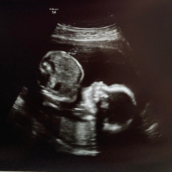 Babylist Registry Photo.