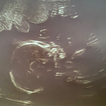 Babylist Registry Photo.