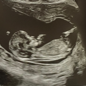 Babylist Registry Photo.