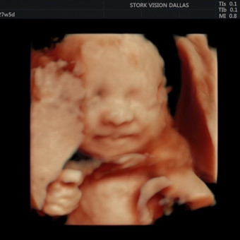 Babylist Registry Photo.