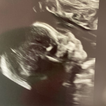 Babylist Registry Photo.