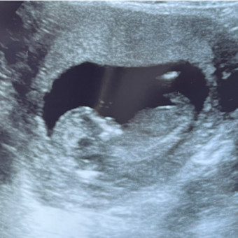 Babylist Registry Photo.