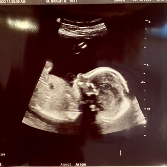 Babylist Registry Photo.