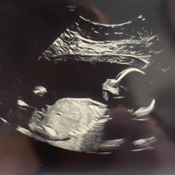 Babylist Registry Photo.