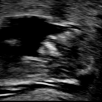 Babylist Registry Photo.