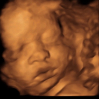 Babylist Registry Photo.