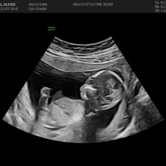 Babylist Registry Photo.