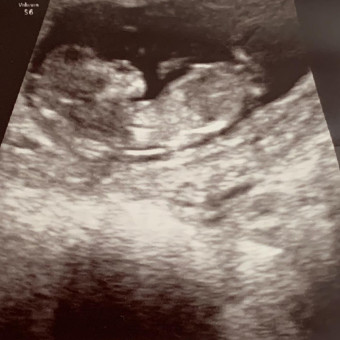 Babylist Registry Photo.