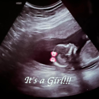 Babylist Registry Photo.