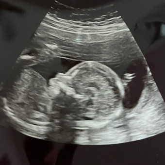 Babylist Registry Photo.