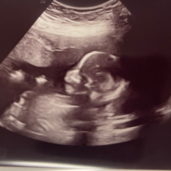 Babylist Registry Photo.