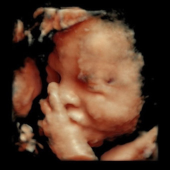 Babylist Registry Photo.