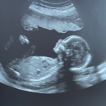 Babylist Registry Photo.