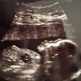 Babylist Registry Photo.
