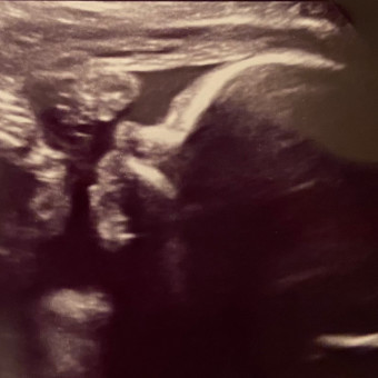 Babylist Registry Photo.