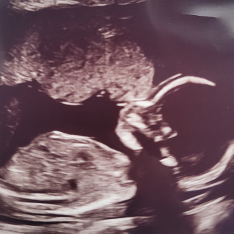 Babylist Registry Photo.