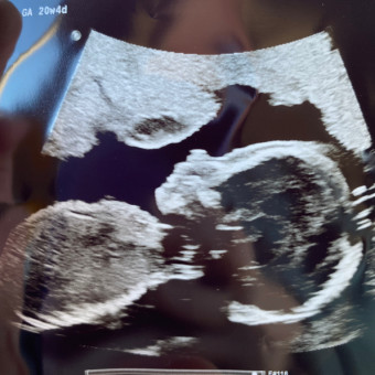 Babylist Registry Photo.