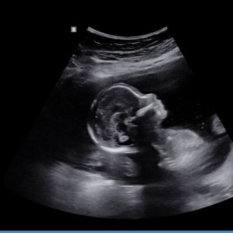 Babylist Registry Photo.