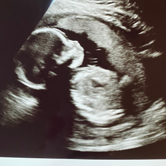 Babylist Registry Photo.