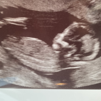 Babylist Registry Photo.