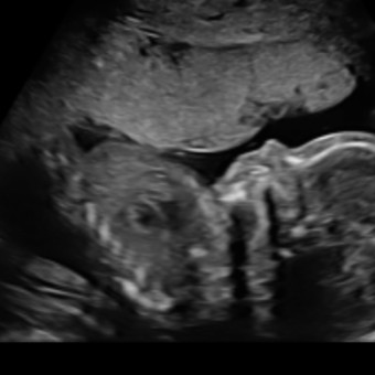 Babylist Registry Photo.