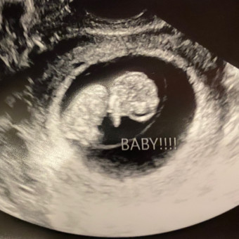 Babylist Registry Photo.