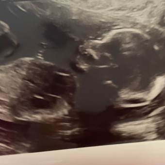 Babylist Registry Photo.