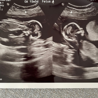 Babylist Registry Photo.