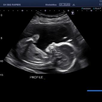 Babylist Registry Photo.
