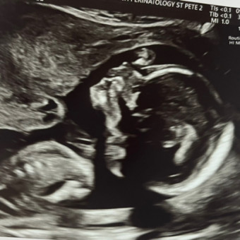 Babylist Registry Photo.