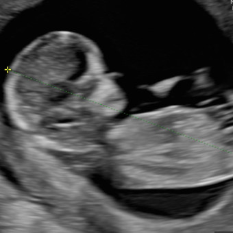 Babylist Registry Photo.