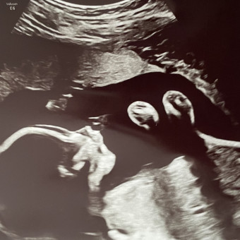 Babylist Registry Photo.
