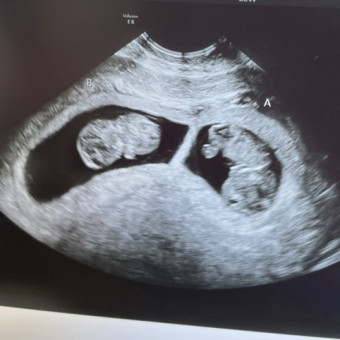 Babylist Registry Photo.
