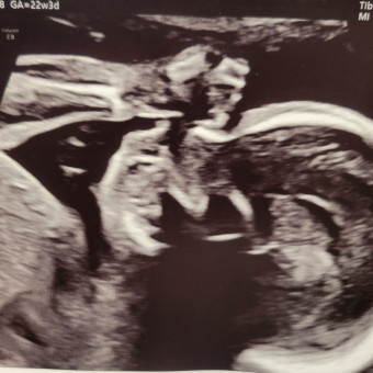 Babylist Registry Photo.