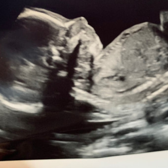 Babylist Registry Photo.