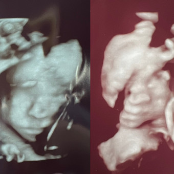 Babylist Registry Photo.