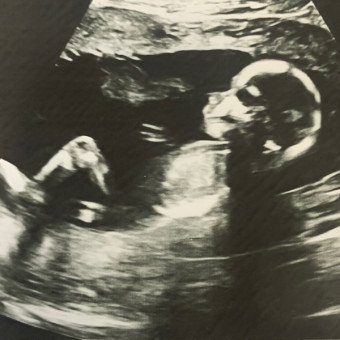 Babylist Registry Photo.