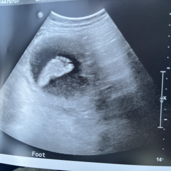Babylist Registry Photo.